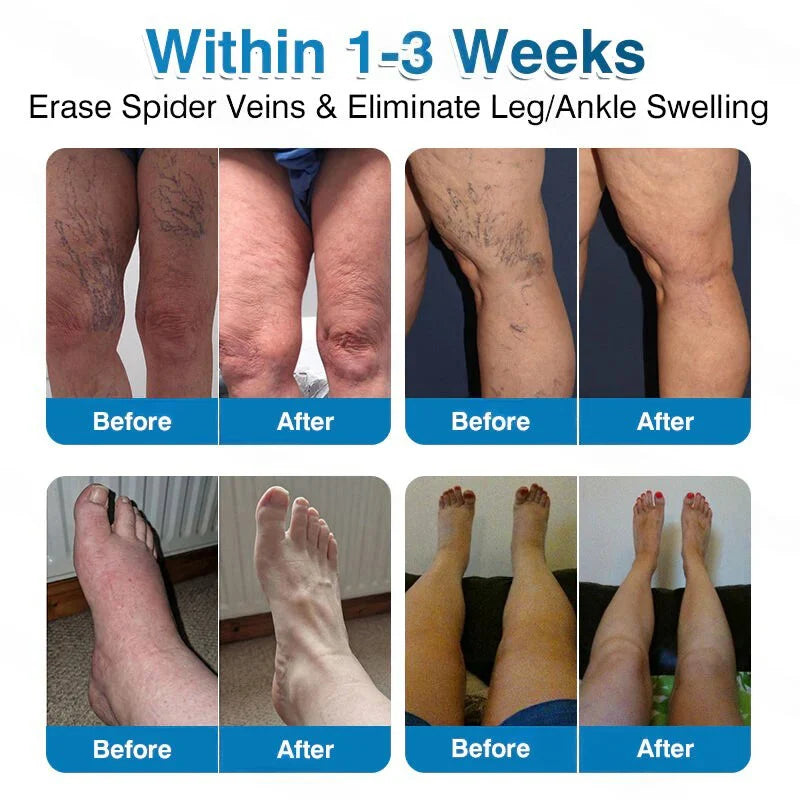🏅🏃 Microneedle Patch Roll⚡Instant Relief, Long-Term Results✨