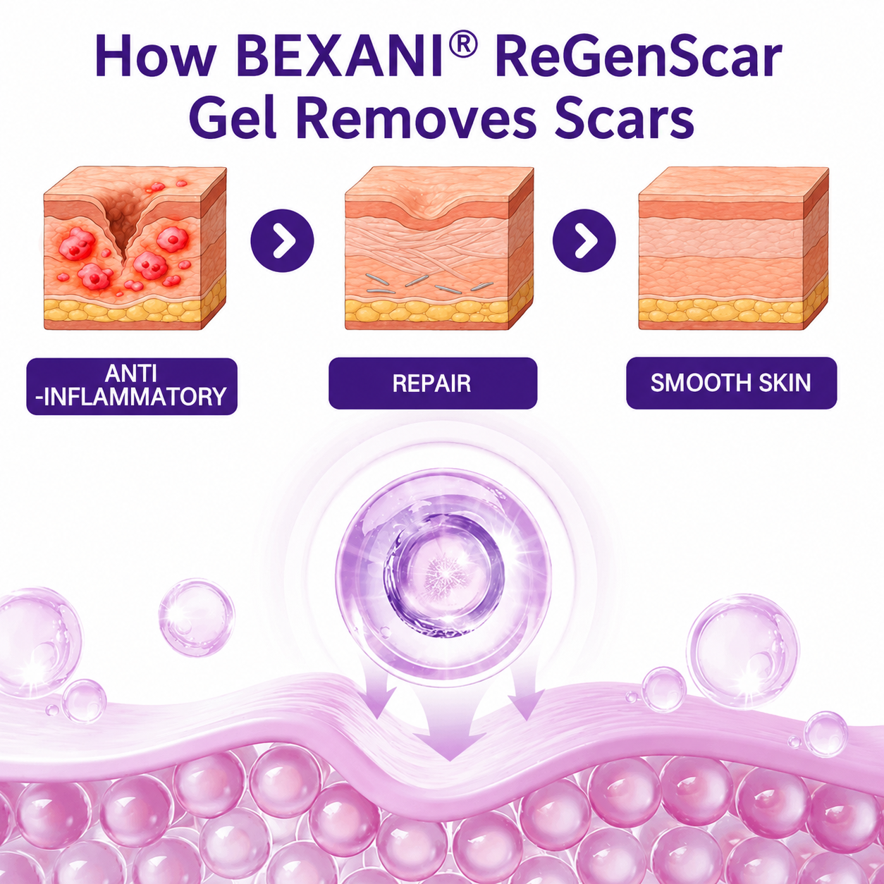 ReGenScar Stem Cell Scar Gel